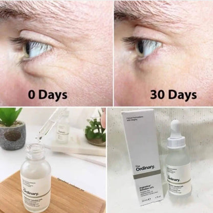 Dark Circles & Eye Care Bundle - Bright Eyes Revival Kit