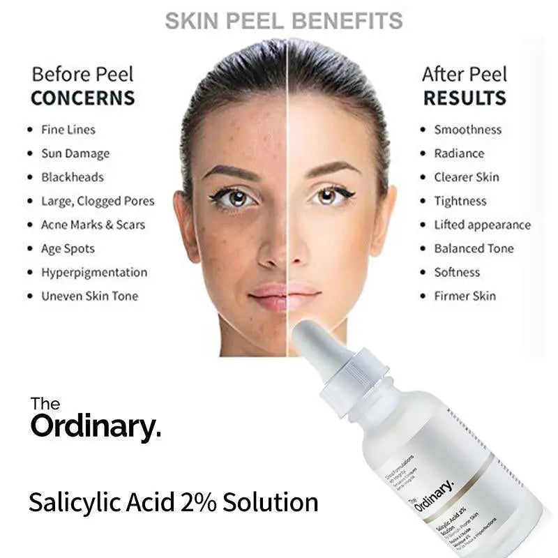 The Ordinary - Salicylic Acid 2% Solution