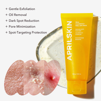 Aprilskin Real Calendula Peel Off Pack Facial Mask - 100g